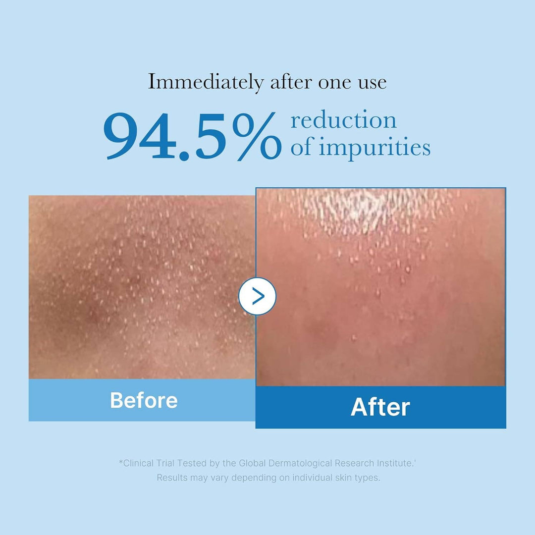 Medicube - Zero Pore Blackhead Deep Cleansing Oil