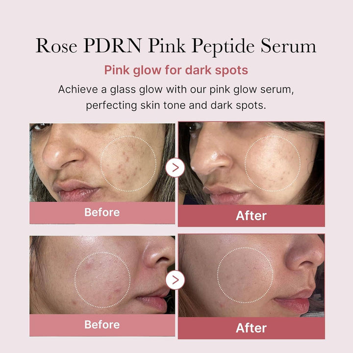 Medicube - Salmon Dna Pdrn Pink Peptide Serum 1.01 Fl.oz.